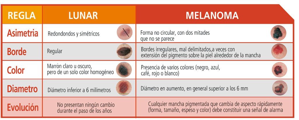 C Mo Controlar Los Lunares Y Prevenir El Melanoma Blog Farmacia Yesfarma